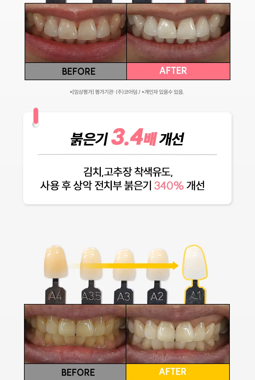 [NEW] 브리올 화이트닝 치아 미백제 4g (치과미백 동일성분) 상세페이지 12